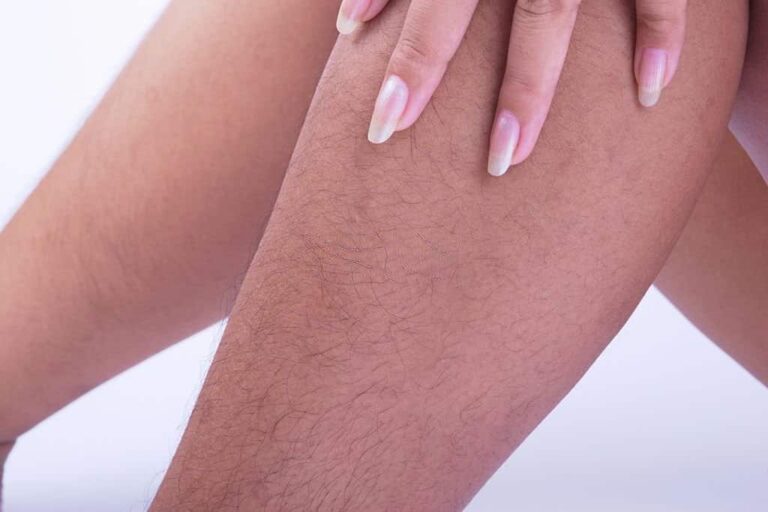 common-causes-of-hair-loss-on-arms-legs-livestrong