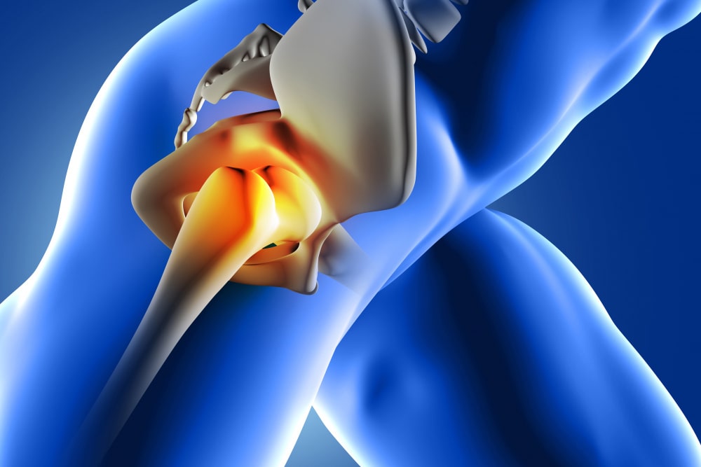 lateral hip pain