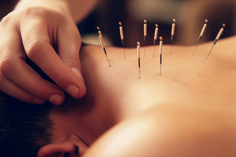 acupuncture for neck pain